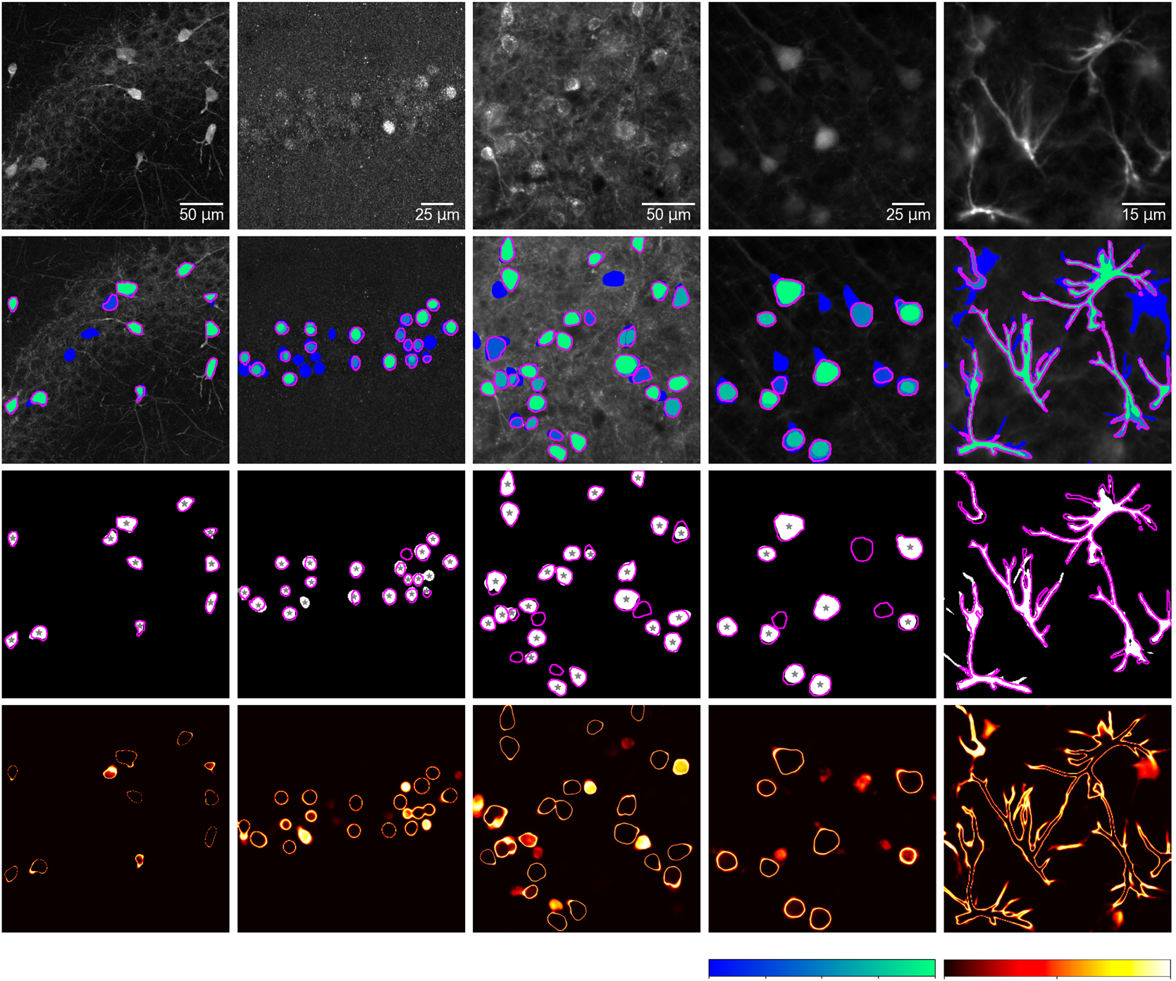 Deep learning segmentation results